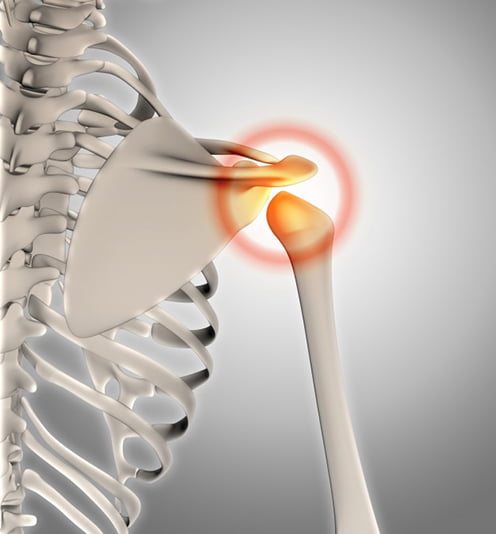 skeleton shoulder pain