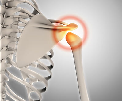 3d skeleton shoulder pain