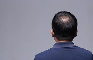 man crown view
