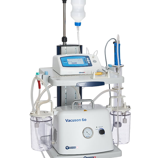 Lipoaspiration